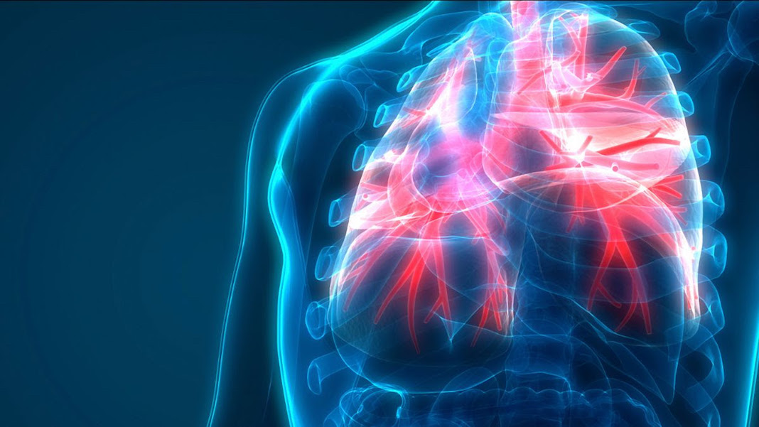 Dieta y enfermedad pulmonar